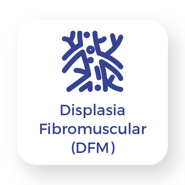 Displasia-Fibromuscular