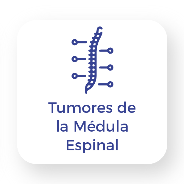 Tumor-de-la-Medula-Espinal